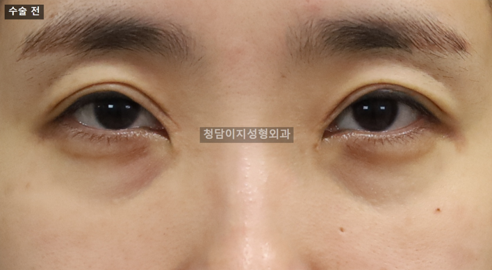 Before Image