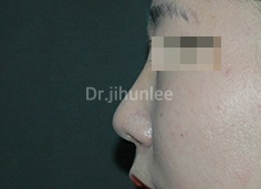 Before Image 3
