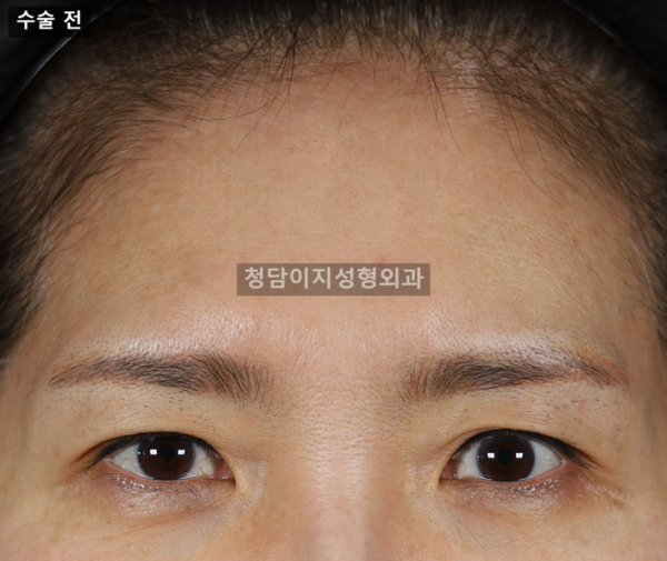 이마거상