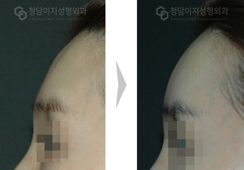Before Image