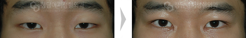 Before Image
