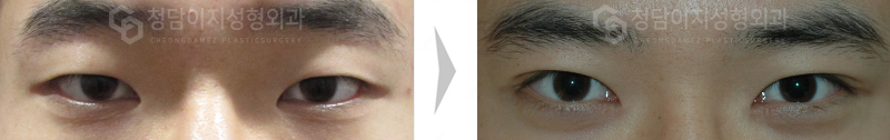 Before Image
