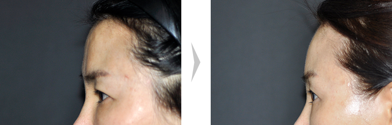 Before Image
