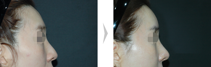 Before Image