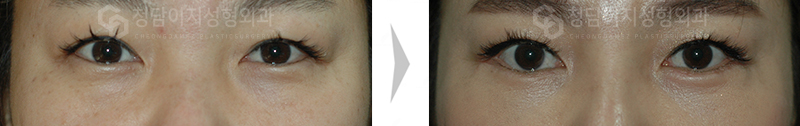 Before Image
