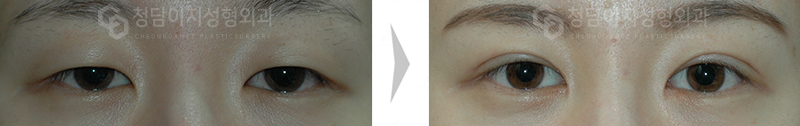 Before Image