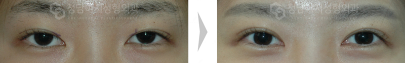 Before Image