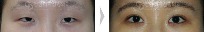 Before Image