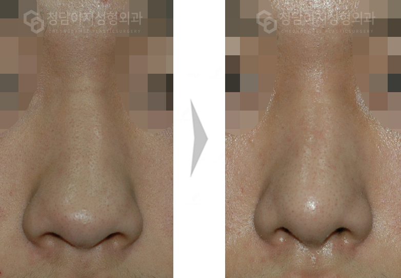 Before Image