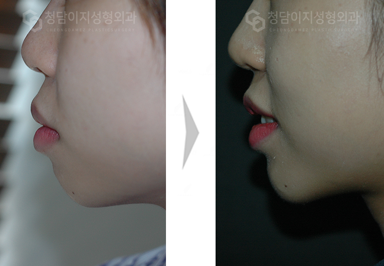 Before Image