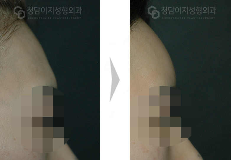 Before Image