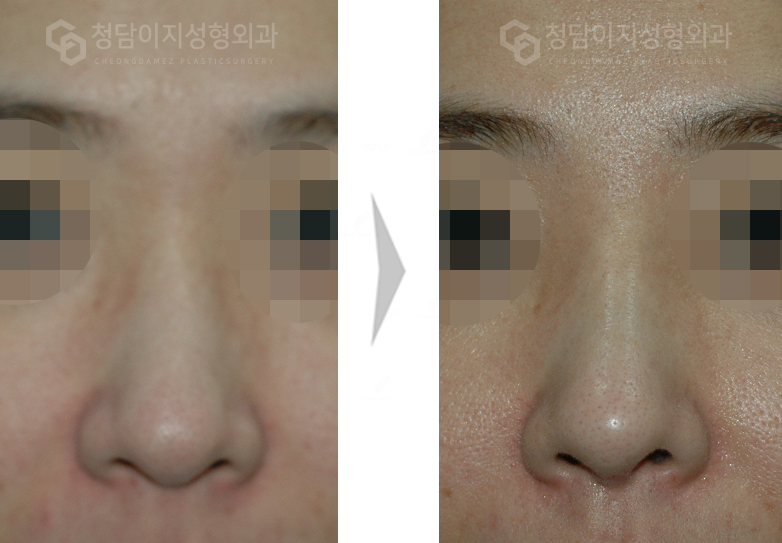 Before Image