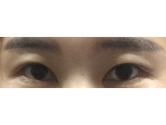 셀카후기 사진