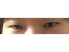 셀카후기 사진