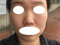 셀카후기 사진