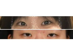 셀카후기 사진