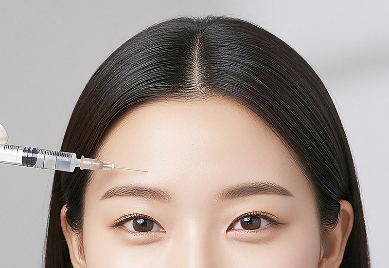 시술 진행 안내 일러스트